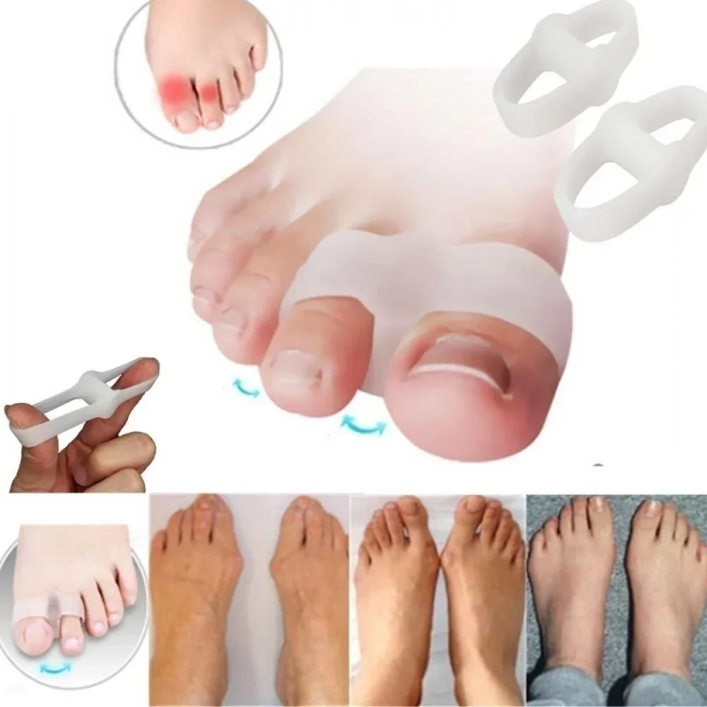 Correcteur d'oignon à 2 trous, - Correction Fluid White avis et prix